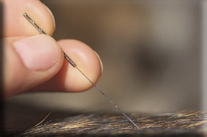 celia merino acupuncture